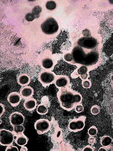 Abstract Circular Shapes in Pink and Black